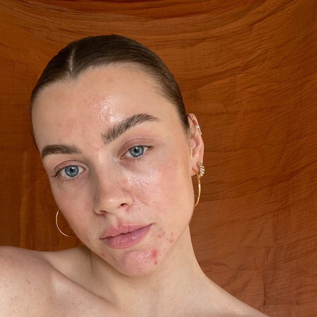 Skin Positivity with Maddie Edwards