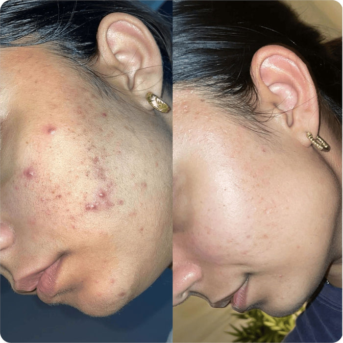 thank you for making me more confident through my skin journey