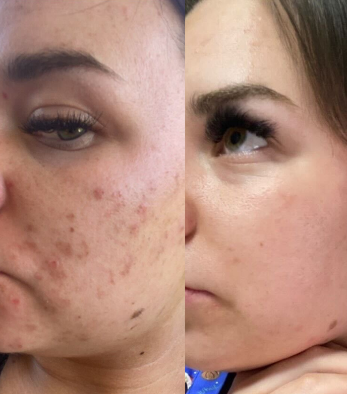 I can't believe the results!